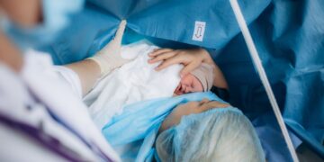 독일 제왕절개 분만, 2023년 사상 최고치 경신…30년 새 두 배로 늘었다